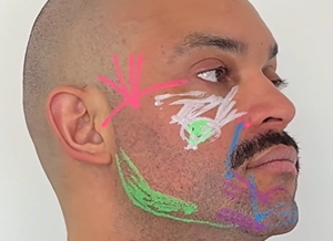Marcación facial masculina para relleno