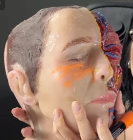 Anatomía aplicada al relleno facial